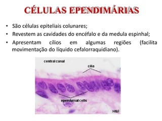 CÉLULAS EPENDIMÁRIAS
• São células epiteliais colunares;
• Revestem as cavidades do encéfalo e da medula espinhal;
• Apresentam cílios em algumas regiões (facilita
movimentação do líquido cefalorraquidiano).
 