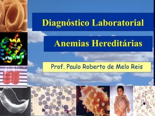 Diagnóstico Laboratorial
Anemias Hereditárias
Prof. Paulo Roberto de Melo Reis
 
