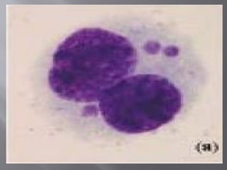 Micronuclei: Microscopic Expression and Clinical Applications in ...
