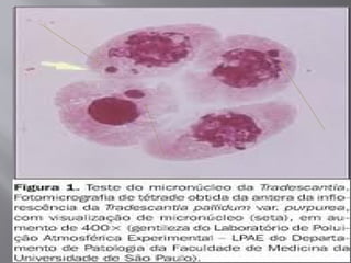 Micronuclei: Microscopic Expression and Clinical Applications in ...