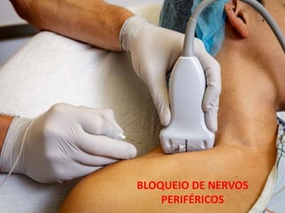 BLOQUEIO DE NERVOS
PERIFÉRICOS
 