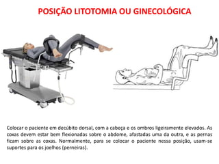 POSIÇÃO LITOTOMIA OU GINECOLÓGICA
Colocar o paciente em decúbito dorsal, com a cabeça e os ombros ligeiramente elevados. As
coxas devem estar bem flexionadas sobre o abdome, afastadas uma da outra, e as pernas
ficam sobre as coxas. Normalmente, para se colocar o paciente nessa posição, usam-se
suportes para os joelhos (perneiras).
 