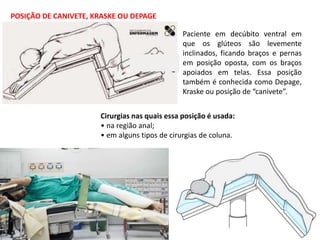 POSIÇÃO DE CANIVETE, KRASKE OU DEPAGE
Paciente em decúbito ventral em
que os glúteos são levemente
inclinados, ficando braços e pernas
em posição oposta, com os braços
apoiados em telas. Essa posição
também é conhecida como Depage,
Kraske ou posição de “canivete”.
Cirurgias nas quais essa posição é usada:
• na região anal;
• em alguns tipos de cirurgias de coluna.
 