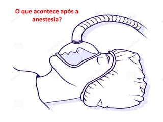 O que acontece após a anestesia?
O que acontece após a
anestesia?
 