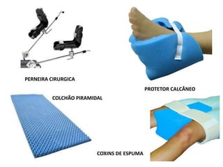 PERNEIRA CIRURGICA
COLCHÃO PIRAMIDAL
PROTETOR CALCÂNEO
COXINS DE ESPUMA
 
