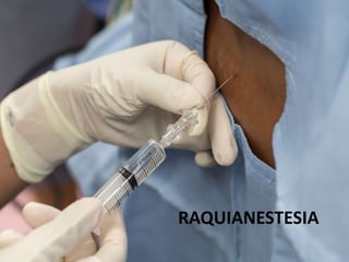 RAQUIANESTESIA
 