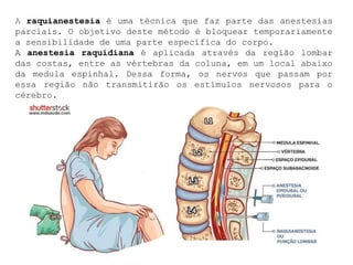 A raquianestesia é uma técnica que faz parte das anestesias
parciais. O objetivo deste método é bloquear temporariamente
a sensibilidade de uma parte específica do corpo.
A anestesia raquidiana é aplicada através da região lombar
das costas, entre as vértebras da coluna, em um local abaixo
da medula espinhal. Dessa forma, os nervos que passam por
essa região não transmitirão os estímulos nervosos para o
cérebro.
 
