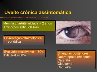 Uveíte crónica assintomática

Menina c/ artrite iniciada < 2 anos
Anticorpos antinucleares


Observação oftalmológica
  periódica


Evolução recidivante – 60%            Sinéquias posteriores
Bilateral – 66%
                                      Queratopatia em banda
                                      Catarata
                                      Glaucoma
                                      Cegueira
 