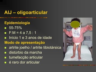 AIJ – oligoarticular

Epidemiologia
 55-75%
 F:M = 4 a 7,5 : 1
 Início 1 e 3 anos de idade
Modo de apresentação
 artrite joelho / artrite tibiotársica
 distúrbio da marcha
 tumefacção articular
 é raro dor articular
 