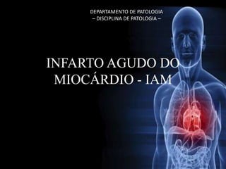 INFARTO AGUDO DO
MIOCÁRDIO - IAM
DEPARTAMENTO DE PATOLOGIA
– DISCIPLINA DE PATOLOGIA –
 
