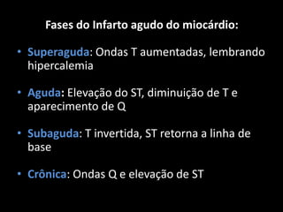 Fases do Infarto agudo do miocárdio:
• Superaguda: Ondas T aumentadas, lembrando
hipercalemia
• Aguda: Elevação do ST, diminuição de T e
aparecimento de Q
• Subaguda: T invertida, ST retorna a linha de
base
• Crônica: Ondas Q e elevação de ST
 