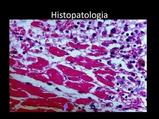 Histopatologia
 