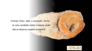 Corpo lúteo: após a ovulação, forma-
se uma cavidade cística irregular onde
não se observa a papila ovulatória
 