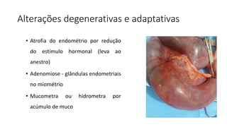 Alterações degenerativas e adaptativas
• Atrofia do endométrio por redução
do estímulo hormonal (leva ao
anestro)
• Adenomiose - glândulas endometriais
no miométrio
• Mucometra ou hidrometra por
acúmulo de muco
 