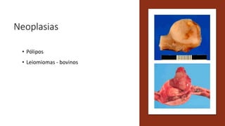 Neoplasias
• Pólipos
• Leiomiomas - bovinos
 