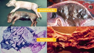 MUMIFICAÇÃO
MACERAÇÃO
 