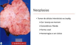 Neoplasias
• Tumor de células intersticiais ou Leydig
Cor: laranja ao marrom
Consistência: flácido
Forma: oval
Hemorragias e ser cístico
 