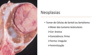 Neoplasias
• Tumor de Células de Sertoli ou Sertolioma
Maior dos tumores testiculares
Cor: branca
Consistência: firme
Forma: irregular
Feminilização
 