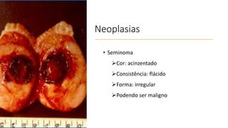 Neoplasias
• Seminoma
Cor: acinzentado
Consistência: flácido
Forma: irregular
Podendo ser maligno
 
