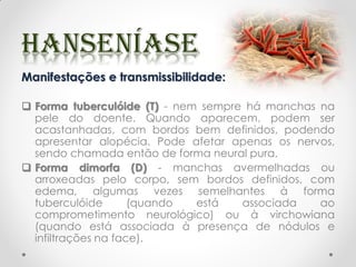 Manifestações e transmissibilidade:
 Forma tuberculóide (T) - nem sempre há manchas na
pele do doente. Quando aparecem, podem ser
acastanhadas, com bordos bem definidos, podendo
apresentar alopécia. Pode afetar apenas os nervos,
sendo chamada então de forma neural pura.
 Forma dimorfa (D) - manchas avermelhadas ou
arroxeadas pelo corpo, sem bordos definidos, com
edema, algumas vezes semelhantes à forma
tuberculóide (quando está associada ao
comprometimento neurológico) ou à virchowiana
(quando está associada à presença de nódulos e
infiltrações na face).
 