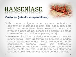 Cuidados (orientar e supervisionar):
 Pés: andar calçado, com sapatos fechados e
confortáveis; massageálos com óleo adequado, para
evitar que ressequem. Fazer exercícios (abaixar e
levantar o peito do pé, brincar de empurrar a parede
com as mãos, para esticar as pernas juntas).
 Ferimentos: imobilizar os dedos e repousar os membros
machucados. Todas as formas de hanseníase podem
causar espessamento dos nervos, provocando lesões
neurológicas. Quando evolui sem tratamento,
principalmente nas formas multibacilares, pode haver
acometimento dos ossos e do tecido de sustentação,
causando deformidades nas mãos e pés dos doentes.
 
