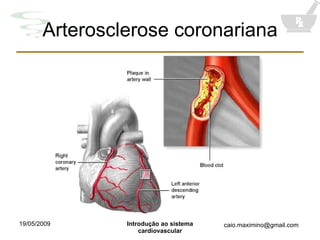 Arterosclerose coronariana 