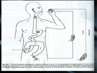 Oxyridae - Enterobius vermicularis - EnterobíaseOxyridae - Enterobius vermicularis - Enterobíase
 