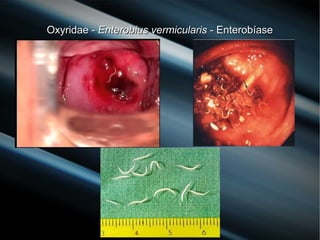 Oxyridae -Oxyridae - Enterobius vermicularisEnterobius vermicularis - Enterobíase- Enterobíase
 