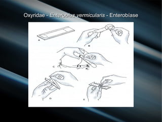 Oxyridae -Oxyridae - Enterobius vermicularisEnterobius vermicularis - Enterobíase- Enterobíase
 