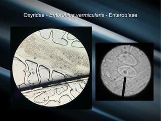 Oxyridae -Oxyridae - Enterobius vermicularisEnterobius vermicularis - Enterobíase- Enterobíase
 