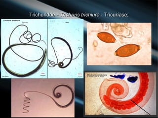 Trichuridae -Trichuridae - Trichuris trichiuraTrichuris trichiura - Tricuríase;- Tricuríase;
 