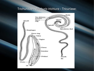 Trichuridae -Trichuridae - Trichuris trichiuraTrichuris trichiura - Tricuríase;- Tricuríase;
 