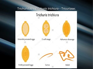 Trichuridae -Trichuridae - Trichuris trichiuraTrichuris trichiura - Tricuríase;- Tricuríase;
 