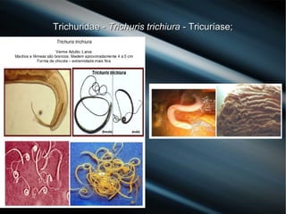 Trichuridae -Trichuridae - Trichuris trichiuraTrichuris trichiura - Tricuríase;- Tricuríase;
 
