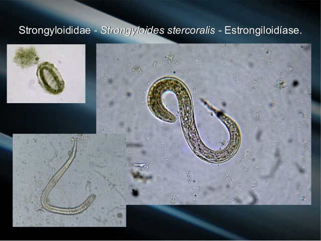 Aula 11 Necator, Ancylostoma, Enterobius, Trichurus