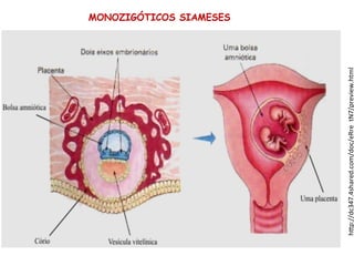 h%p://dc347.4shared.com/doc/eRre_tN7/preview.html"
MONOZIGÓTICOS SIAMESES
 