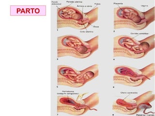 PARTO
 