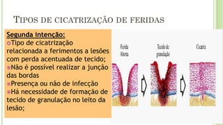TIPOS DE CICATRIZAÇÃO DE FERIDAS
Segunda intenção:
Tipo de cicatrização
relacionada a ferimentos a lesões
com perda acentuada de tecido;
Não é possível realizar a junção
das bordas
Presença ou não de infecção
Há necessidade de formação de
tecido de granulação no leito da
lesão;
 