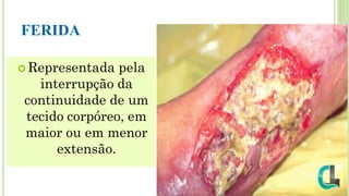 FERIDA
 Representada pela
interrupção da
continuidade de um
tecido corpóreo, em
maior ou em menor
extensão.
 