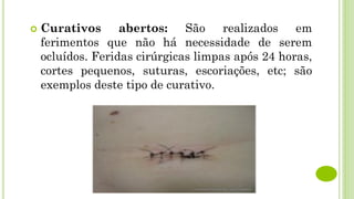  Curativos abertos: São realizados em
ferimentos que não há necessidade de serem
ocluídos. Feridas cirúrgicas limpas após 24 horas,
cortes pequenos, suturas, escoriações, etc; são
exemplos deste tipo de curativo.
 