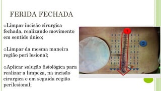 FERIDA FECHADA
oLimpar incisão cirurgica
fechada, realizando movimento
em sentido único;
oLimpar da mesma maneira
região peri lesional;
oAplicar solução fisiológica para
realizar a limpeza, na incisão
cirurgica e em seguida região
perilesional;
 