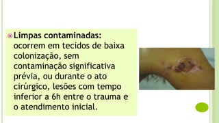Limpas contaminadas:
ocorrem em tecidos de baixa
colonização, sem
contaminação significativa
prévia, ou durante o ato
cirúrgico, lesões com tempo
inferior a 6h entre o trauma e
o atendimento inicial.
 