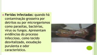  Feridas infectadas: quando há
contaminação grosseira por
detritos ou por microrganismos
como parasitas, bactérias,
vírus ou fungos. Apresentam
evidências do processo
infeccioso, como tecido
desvitalizado, exsudação
purulenta e odor
característico.
 