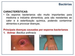 Bactérias
CARACTERÍSTICAS:
• Os esporos bacterianos são muito importantes para
medicina e indústria alimentícia, pois são resistentes ao
calor e à esterilização química, podendo contaminar
alimentos e provocar doenças.
Principais doenças causadas por esporos bacterianos
1. Antraz: Bacillus anthracis
 