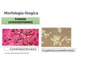 Morfologia fúngica
FUNGOS
LEVEDURIFORMES
Cryptococcusneoformans
Fonte: https://images.app.goo.gl/VVEQ4en6aEveEkYB8
C a n d i d a a l b i c an s
 