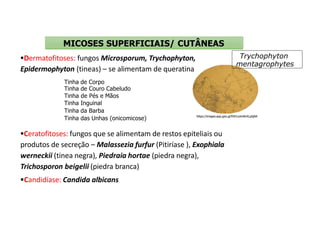 Ceratofitoses: fungos que se alimentam de restos epiteliais ou
produtos de secreção – Malassezia furfur (Pitiríase ), Exophiala
werneckii (tinea negra), Piedraia hortae (piedra negra),
Trichosporon beigelii (piedra branca)
Candidíase: Candida albicans
MICOSES SUPERFICIAIS/ CUTÂNEAS
Trychophyton
mentagrophytes
https://images.app.goo.gl/fiVhLsnm8nXLpdjAA
Dermatofitoses: fungos Microsporum, Trychophyton,
Epidermophyton (tineas) – se alimentam de queratina
Tinha de Corpo
Tinha de Couro Cabeludo
Tinha de Pés e Mãos
Tinha Inguinal
Tinha da Barba
Tinha das Unhas (onicomicose)
 