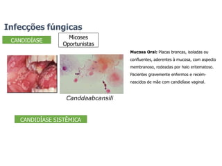 CANDIDÍASE
Infecções fúngicas
Micoses
Oportunistas
Mucosa Oral: Placas brancas, isoladas ou
confluentes, aderentes à mucosa, com aspecto
membranoso, rodeadas por halo eritematoso.
Pacientes gravemente enfermos e recém-
nascidos de mãe com candidíase vaginal.
Canddaabcansili
CANDIDÍASE SISTÊMICA
 