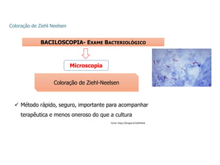 Coloração de Ziehl Neelsen
BACILOSCOPIA- EXAME BACTERIOLÓGICO
Microscopia
Coloração de Ziehl-Neelsen
 Método rápido, seguro, importante para acompanhar
terapêutica e menos oneroso do que a cultura
Fonte: https://binged.it/32RhMv6
 