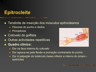 Epitrocleíte

   Tendinite de inserção dos músculos epitrocleanos
       Flexores do punho e dedos
       Pronadores
   Cotovelo do golfista
   Outras actividades repetitivas
   Quadro clínico:
       Dor na face interna do cotovelo
       Dor agrava-se pela flexão e pronação contrariada do punho
       Dor à palpação do tubérculo ósseo inferior e interno do úmero -
        epitróclea
 