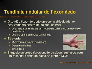 Tendinite nodular do flexor dedo
   O tendão flexor do dedo apresenta dificuldade no
    deslizamento dentro da bainha sinovial
       quer pela existência de um nódulo na bainha do tendão flexor
        do dedo ou
       pela fibrose e estenose da bainha.
   Etiologia
       Microtraumatismos (profissão)
       Diabetes mellitus
       amiloidose
   Bloqueio doloroso da extensão do dedo, que cede com
    um ressalto. O nódulo palpa-se junto à MCF
 